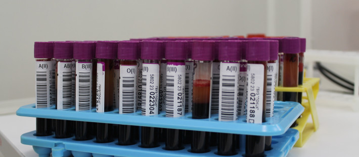 В Пензе необходимы доноры трех групп крови