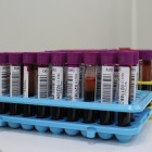 В Пензе разыскивают доноров двух групп крови