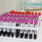 В Пензе наблюдается острая нехватка донорской крови двух групп