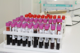 В Пензе наблюдается острая нехватка донорской крови двух групп