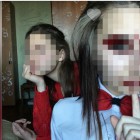 Девочки из Хабаровска выкалывали глаза животным и убивали их 