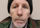 В Пензе разыскивают мужчину со шрамом на лице