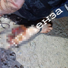 Не для слабонервных: житель Пензенской области гулял по поселку со своей отрезанной рукой