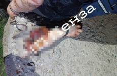 Не для слабонервных: житель Пензенской области гулял по поселку со своей отрезанной рукой