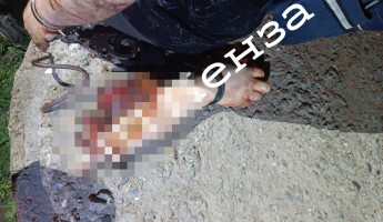 Не для слабонервных: житель Пензенской области гулял по поселку со своей отрезанной рукой