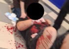 Пензенцы сообщили об окровавленном мужчине, лежавшем возле автомата с игрушками в ЦУМе