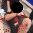 Пензенцы сообщили об окровавленном мужчине, лежавшем возле автомата с игрушками в ЦУМе