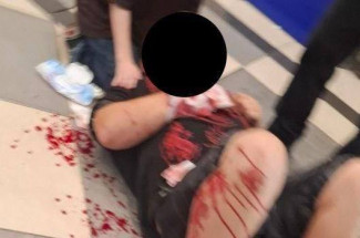 Пензенцы сообщили об окровавленном мужчине, лежавшем возле автомата с игрушками в ЦУМе