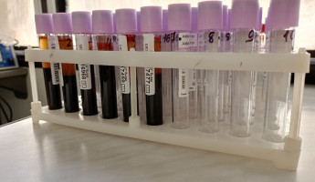 Кто чаще болеет ВИЧ в Пензенской области: свежая статистика Кто чаще болеет ВИЧ в Пензенской области: свежая статистика