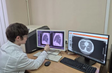 Бесплатная флюорография для пензенцев: названы даты в марте