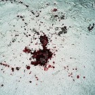В Пензе злоумышленники зверски избили мужчину на остановке, а после забрали все его деньги