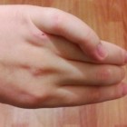 Жительница Пензы: «Из-за спора на дороге женщина сломала мне палец!»