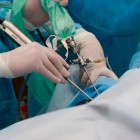 Травматологи Пензы научились делать операции без разрезов