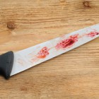 В Пензе 43-летняя женщина вонзила нож в живот соседке