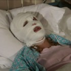 Уроженке Пензы изуродовали лицо в клинике пластической хирургии 
