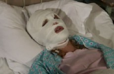 Уроженке Пензы изуродовали лицо в клинике пластической хирургии 