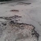 У жителя Пензенской области «рассыпался» позвоночник из-за ямы на дороге 