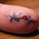 В Пензенской области необученная сотрудница ООО «Технотекс» порвала палец