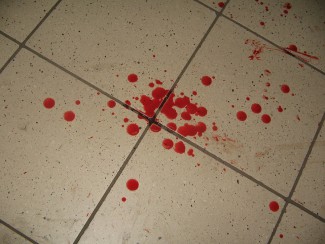 В Пензе женщина напала на собственного супруга с ножом