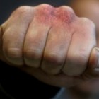 В Арбеково агрессивный клиент едва «не раскрошил» челюсть сотруднику СТО