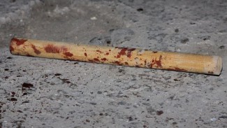 Жительница Пензенской области сломала нос сельчанину палкой 