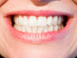 «Бережный к эмали»: женщина пыталась отбелить зубы средством для чистки унитаза