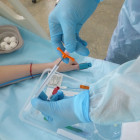 В Пензенской области больных туберкулезом будут лечить по новой методике
