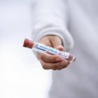 За сутки в Пензенской области выявили более 20 случаев коронавируса