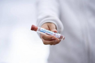 За сутки в Пензенской области выявили более 20 случаев коронавируса