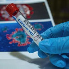 В Пензе провели уже более 40 тысяч исследований на коронавирус