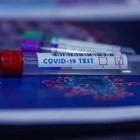 В Пензе проведено уже более 47 тысяч исследований на коронавирус