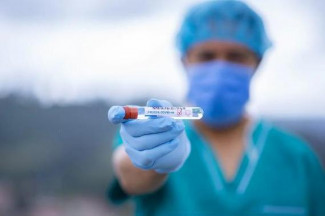 В Пензенской области выявлено 72 новых случая коронавируса