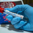 В Пензе провели уже более 78 тысяч исследований на коронавирус