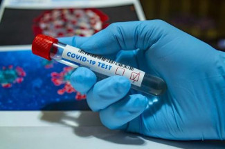 В Пензе провели уже более 78 тысяч исследований на коронавирус