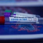 В Пензенской области провели около 134 тысяч тестов на коронавирус