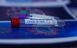 В Пензенской области провели около 134 тысяч тестов на коронавирус