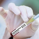 В Пензенской области провели около 156 тысяч тестов на коронавирус