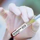 В Пензенской области провели около 198 тысяч тестов на коронавирус