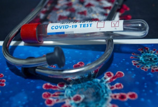 В Пензенской области провели более 295 тысяч тестов на коронавирус