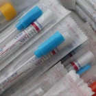 В Пензенской области провели более 585 тысяч тестов на коронавирус