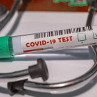 В Пензенской области провели около 647 тысяч тестов на коронавирус