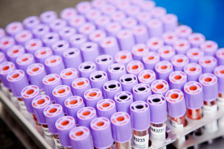 В Пензенской области провели более 777 тысяч тестов на коронавирус