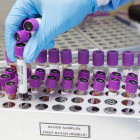 В Пензенской области провели более 780 тысяч тестов на коронавирус