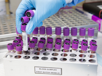 В Пензенской области провели более 780 тысяч тестов на коронавирус