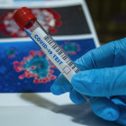В Пензенской области число случаев заражения коронавирусом превысило 40 тысяч