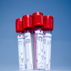 В Пензенской области провели более 831 тысячи тестов на коронавирус