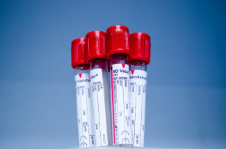В Пензенской области провели более 831 тысячи тестов на коронавирус