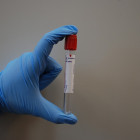 Почти 63% населения Пензенской области прошли тест на коронавирус