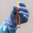 В Пензенской области провели более 933 тысяч тестов на коронавирус