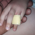 В Пензе кольцо с пальца ребенка пришлось снимать спасателям